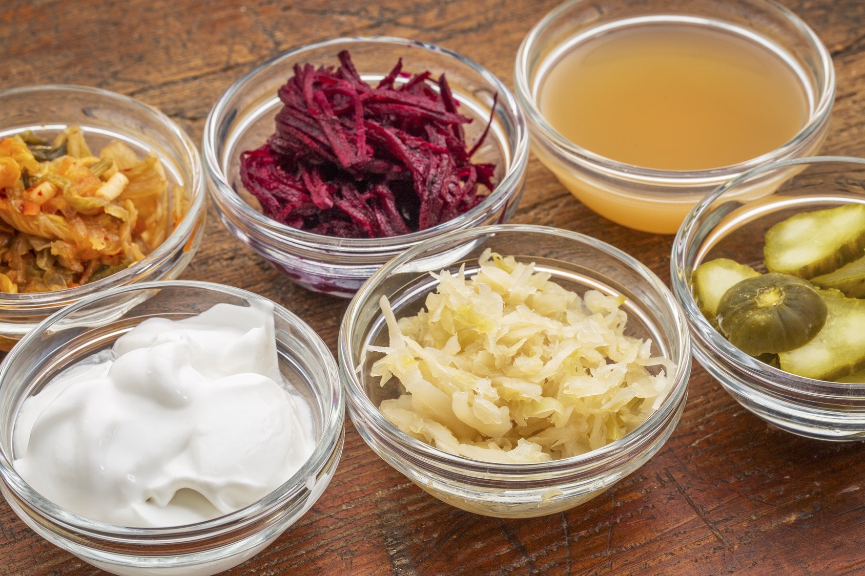 12 Probiotic Foods For Improved Gut Health