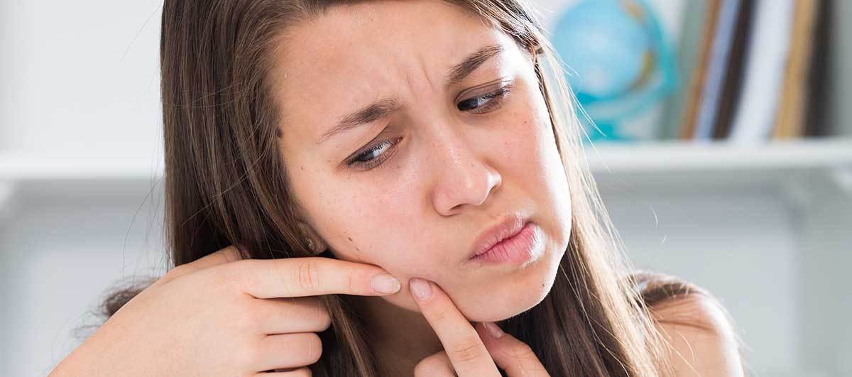 Como tratar acne adolescente