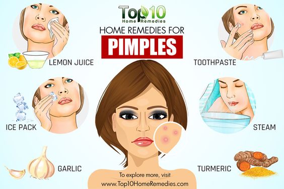 10 Home Remedies To Get Rid of Pimples